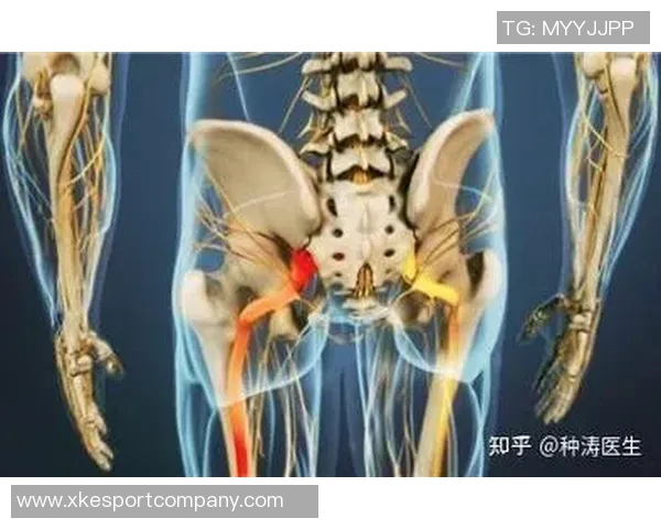 专家解读坐骨神经痛成因及治疗方法大多数患者可避免手术治疗
